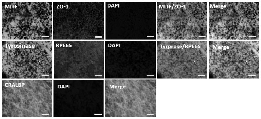 Preparation method of stent-free retinal pigment epithelial cell sheet