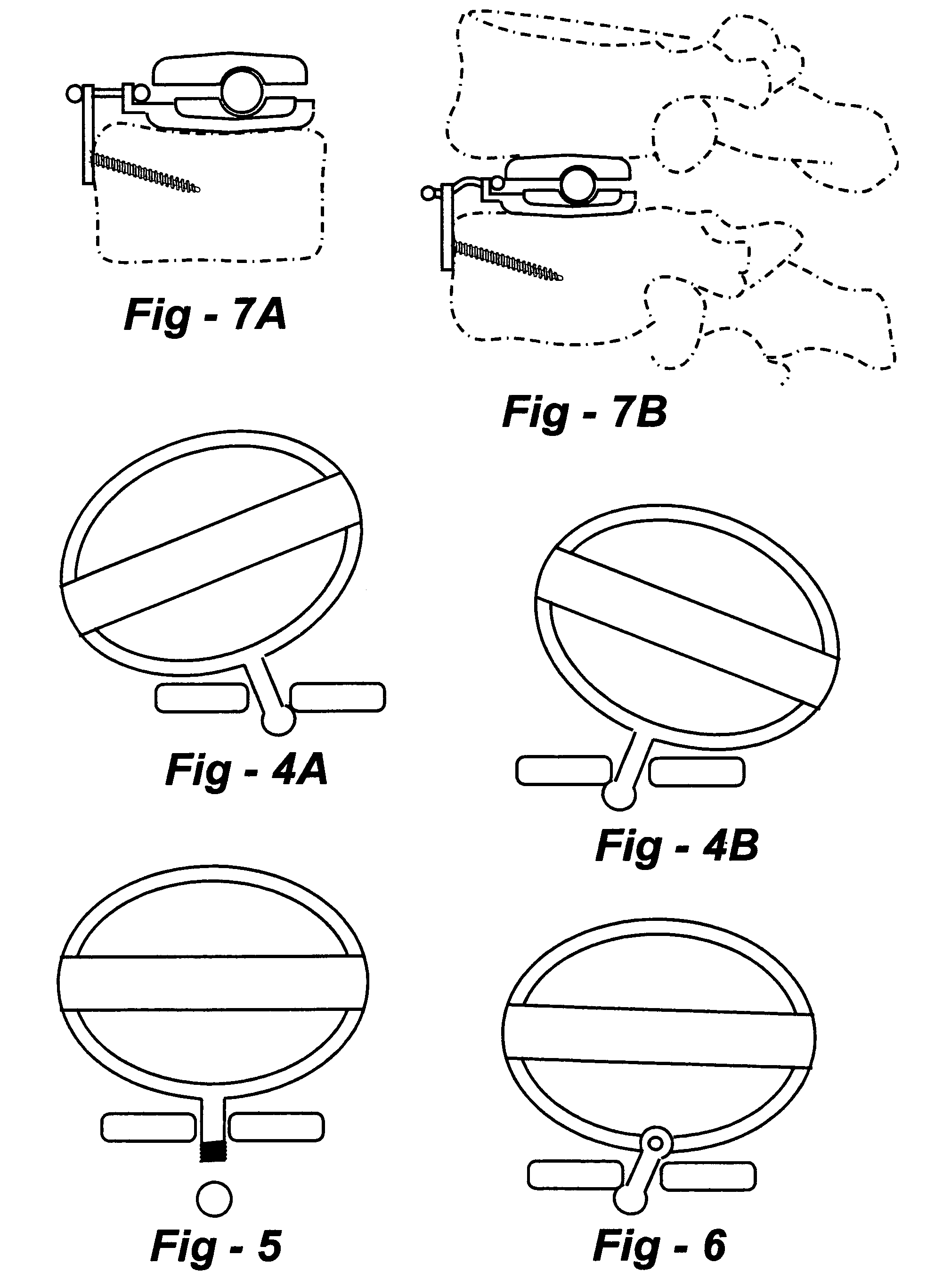 Methods and apparatus for preventing the migration of intradiscal devices