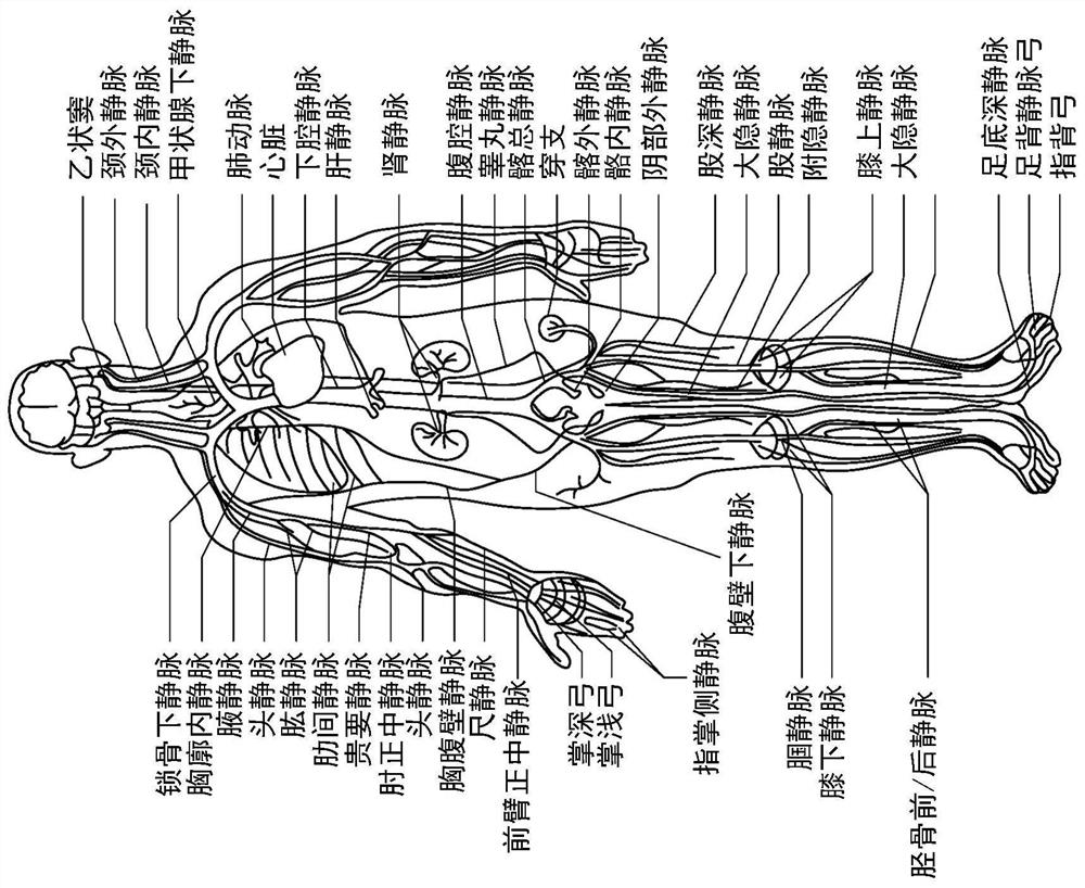 Intraluminal ultrasound directional guidance and associated devices, systems, and methods