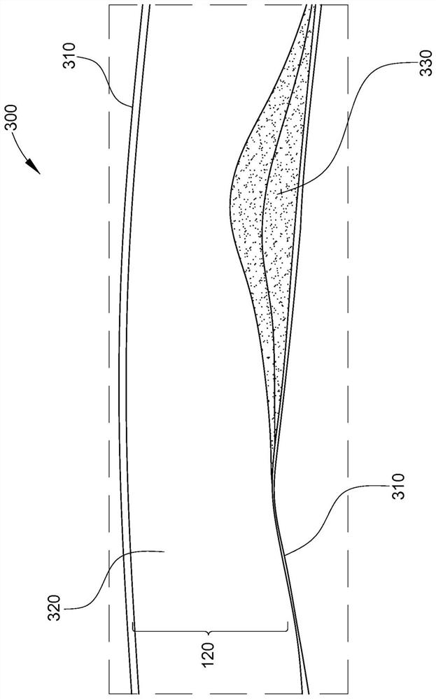 Intraluminal ultrasound directional guidance and associated devices, systems, and methods