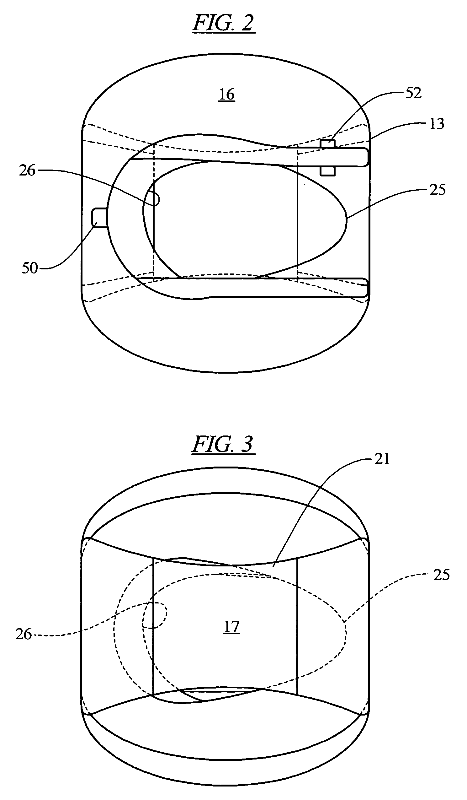 Glide sleeve brace