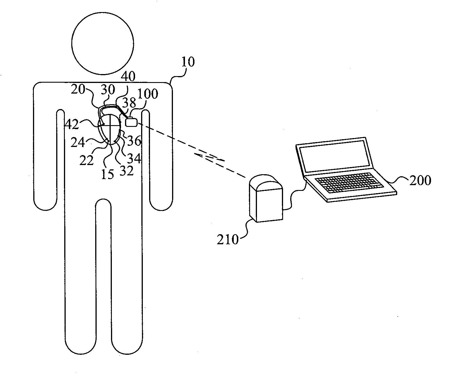 Pacing sequence optimization