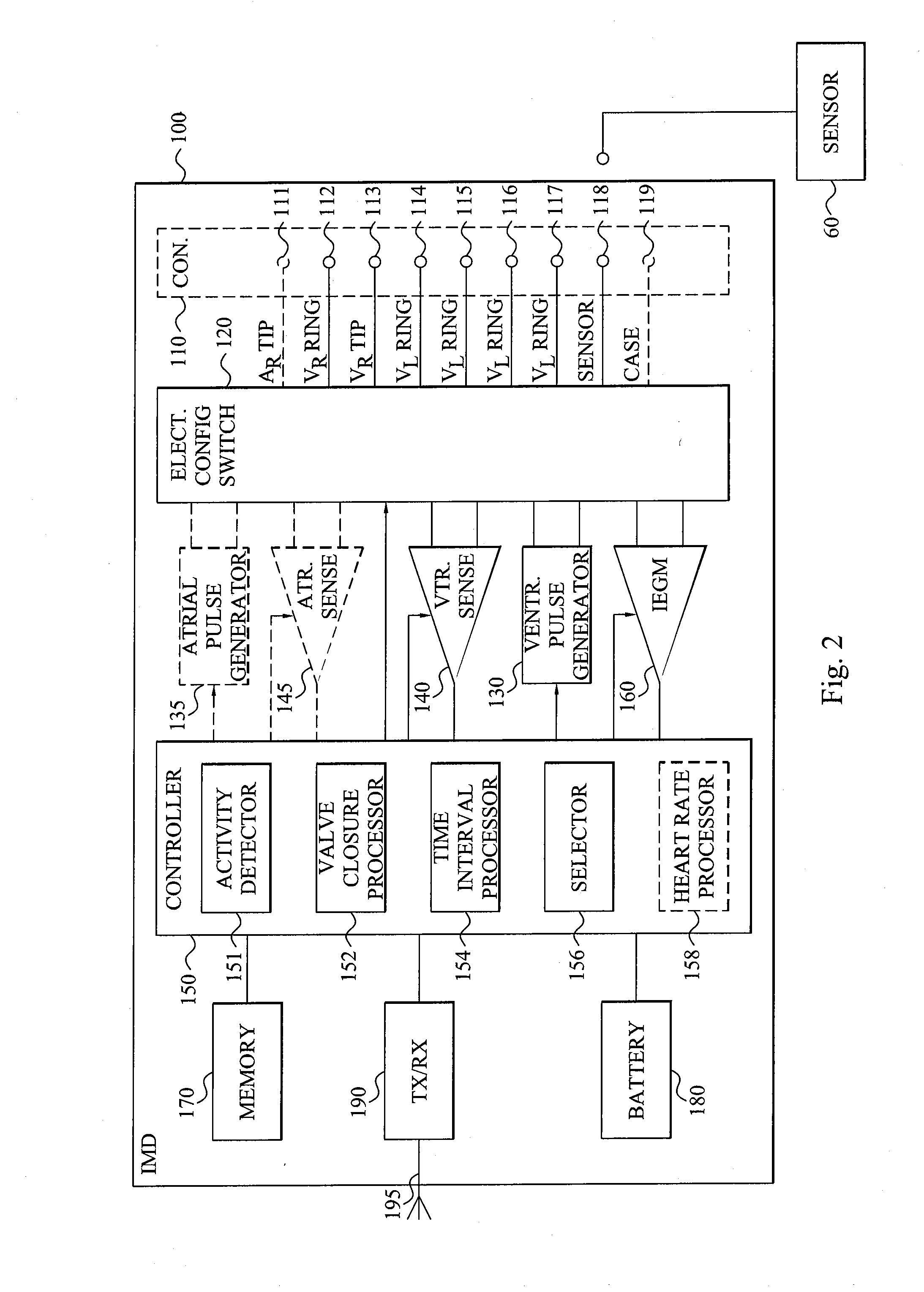 Pacing sequence optimization