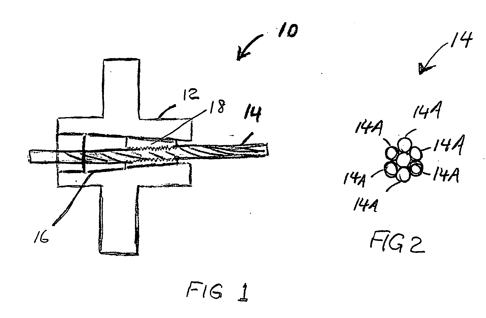 Anchor wedge configuration tendon anchors