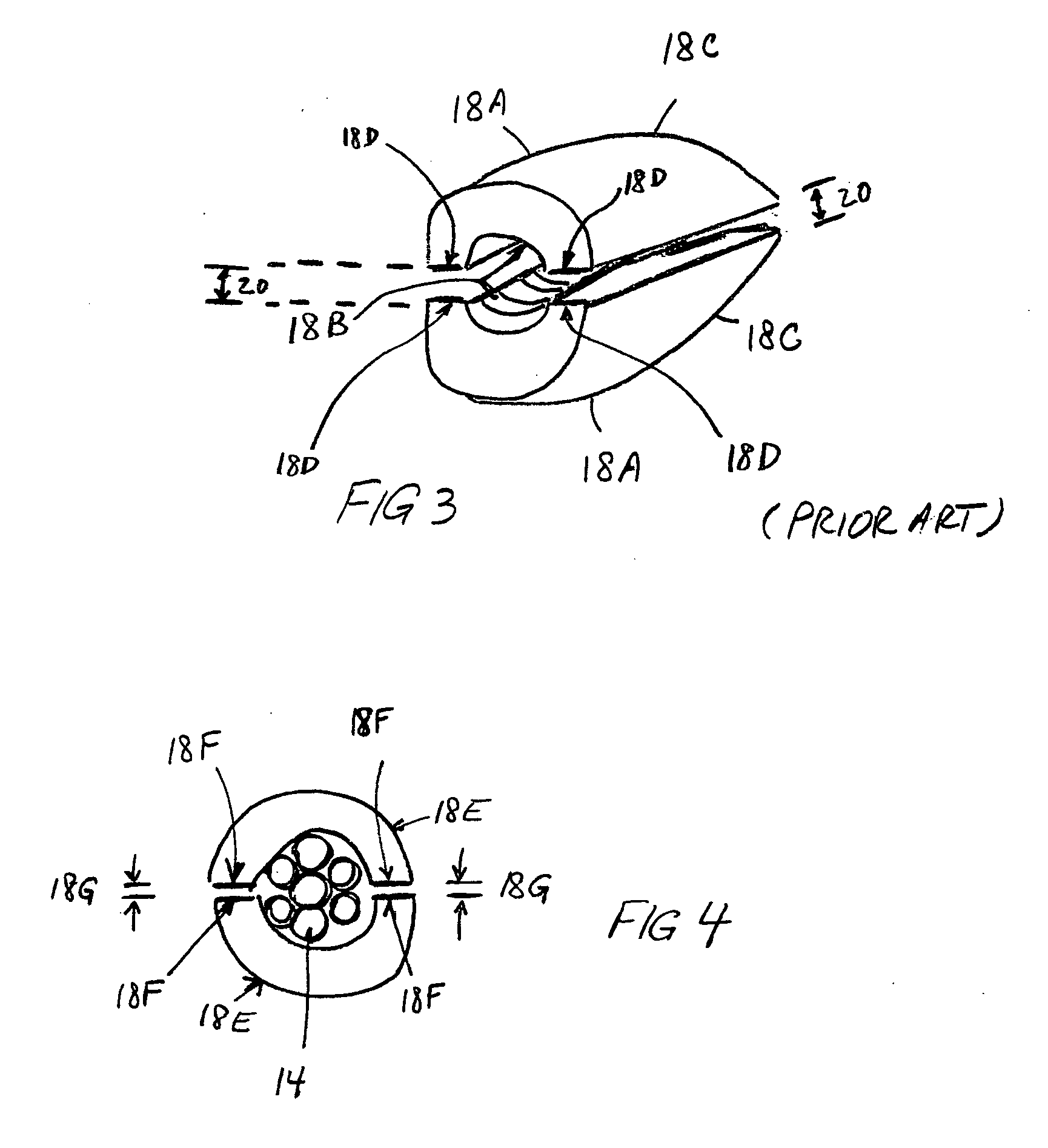 Anchor wedge configuration tendon anchors